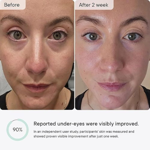 Micro-Infusion Targeted Patches